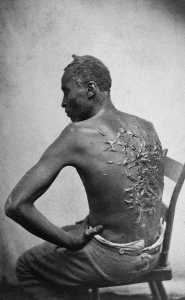 Scourged back by McPherson & Oliver, 1863, retouched